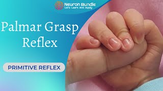 Palmar Grasp Reflex  newbornreflex cerebralpalsy spinalreflex newbornassessment neonatal [upl. by Anahpets]