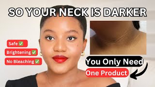 HOW TO TREAT AND GET RID OF DARK NECK amp HYPERPIGMENTATION PERMANENTLY FOR A BRIGHT AN EVEN SKINTONE [upl. by Modern]