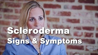 Signs and Symptoms of Scleroderma  Johns Hopkins [upl. by Attalanta724]