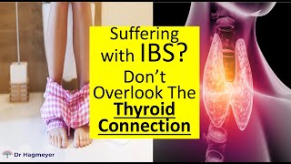 The Connection Between Thyroid Disease amp IBSDr Hagmeyer [upl. by Leiuqese407]