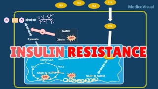 Insulin Resistance Part 2 Basal Lipolysis Free Fatty Acids and Randle cycle Hypothesis [upl. by Phip]