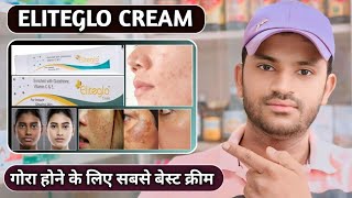 Eliteglo cream uses dose benefits and Side effects full review in hindi [upl. by Shear571]