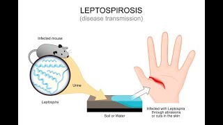 Understanding Leptospirosis Symptoms and Treatment  Expert Guide [upl. by Asik]