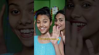 DIY pimple hack 😱 l Quick fix of your pimple hack diy shorts sonalimakeover [upl. by Rika]