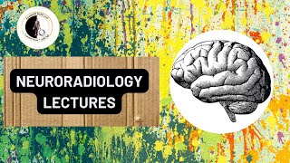 White matter Disorders  Dr Gehad Saleh [upl. by Nogras]