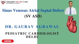 Sinus Venosus Atrial Septal defect Dr Gaurav Agrawal Senior Child Heart Diseases expert Delhi [upl. by Tonya]