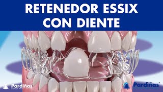 Retenedor ESSIX con diente  Una solución provisional para los DIENTES FALTANTES © [upl. by Yelkao]