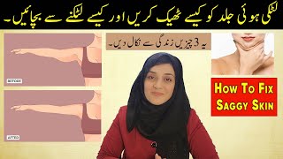 How To Fix Sagging Skin After Weight Lose  3 Chezain Zindagi Se Nikal Dain  Saggy Skin Problem [upl. by Ennaylime519]