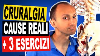 Cruralgia la Causa e 3 Esercizi di Fisioterapia [upl. by Ciredec]