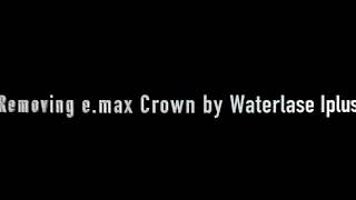 e max Crown removal by Waterlase Iplus [upl. by Ethel]