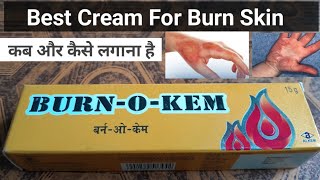 Burn O Kem Cream Antiseptic cream [upl. by Salli703]