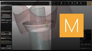 Abutments software module of ZirkonzahnModellier  ZirkonzahnSoftware [upl. by Eyot]