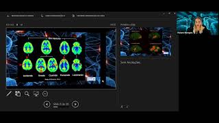 Aula de Neurologia Clínica e Neuroimagem Aplicada à Fonoaudiologia  SEMAC Fonoaudiologia UFRGS [upl. by Boff243]