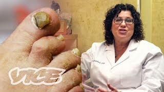 Meet a Toenail Fungus Expert [upl. by Nyrhtak]