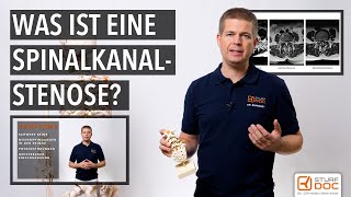 Spinalkanalstenose  Teil 1 Von der Ursache bis zur Erkrankung  Rollator früh verhindern [upl. by Laeria]