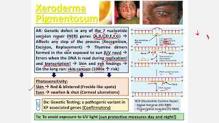 Xeroderma Pigmentosa CBL [upl. by Yesllek545]