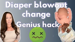 Diaper change blowout Genius hack [upl. by Basile608]