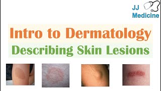 Introduction to Dermatology  The Basics  Describing Skin Lesions Primary amp Secondary Morphology [upl. by Motteo398]