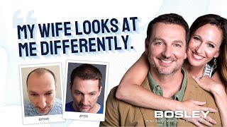 Bosley Hair Transplant Review  Chuck I [upl. by Tudela64]