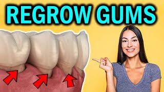 How to Regrow Receding Gums Naturally Reverse Gum Recession without Surgery [upl. by Beckerman]