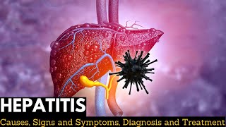 Hepatitis Causes Signs and Symptoms Diagnosis and Treatment [upl. by Rumilly]