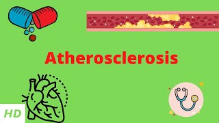 Atherosclerosis Causes Signs and Symptoms Diagnosis and Treatment [upl. by Seldon]