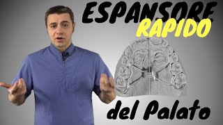 Espansore Rapido del Palato [upl. by Ennaharas]