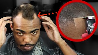 FIXING MY CLIENTS BALD SPOTS😳 HIGH BALD FADE FADED BEARD HAIRCUT TUTORIAL [upl. by Ahsatsana922]