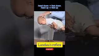 Landaus Reflex  normal baby reflexes  Pediatrics [upl. by Llenoil]