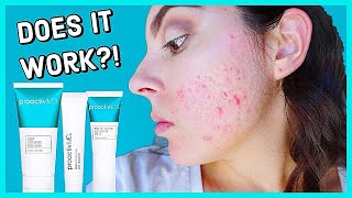 Does Proactiv MD Really Work Honest 2 Month Review [upl. by Bee877]