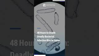 48 hours to death Flesheating bacteria in Japan japan outbreak bacterialdiseases bacteria [upl. by Ihtac139]