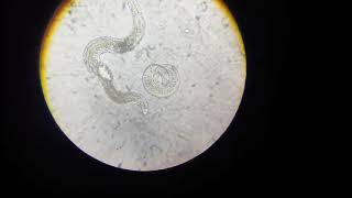 Plant parasitic Nematodes of apricotAphelenchus avenae p2 [upl. by Shayn]