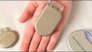 How pacemakers and implantable defibrillators are implanted and used [upl. by Pettiford]