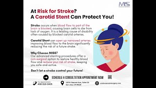 Reduce Stroke Risk with Carotid Stenting [upl. by Annawad]