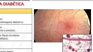 Retinopatías l Oftalmología [upl. by Yracaz]