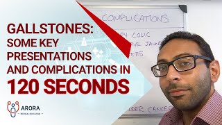 Gallstones some key presentations and complications in 120 seconds [upl. by Omar685]