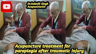 Acupuncture treatment for  Paraplegia in Spinal Cord Injury It Relieves Pain amp Promotes Mobility [upl. by Eillo]