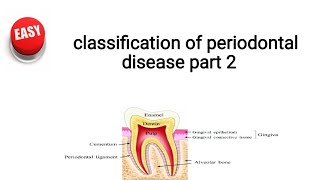 classification of periodontal disease part 2 [upl. by Flavius]