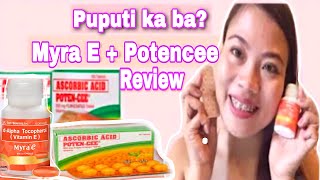 Myra E Potencee Reviewl Puputi Ka Ba  lBest Vitamins for Skin l Hair lMatets TV [upl. by Giffy]