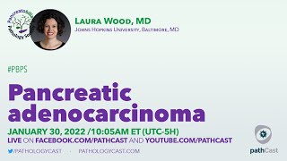 Pancreatic ductal adenocarcinoma and variants  Dr Wood [upl. by Beitnes410]