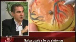 Infarto Fulminante  Dr Antonio Ghattas Parte 13 [upl. by Puttergill]