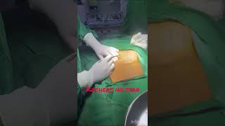 Open cholecystectomy  operative steps [upl. by Elleniad]