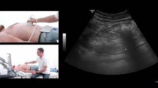 How to perform an ultrasound exam of the pancreas [upl. by Tani739]