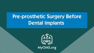 Preprosthetic Surgery Before Dental Implants [upl. by Columbyne813]