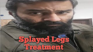 Splayed Legs Treatment  Lovebirds Breeding Tips [upl. by Gilson]