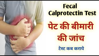 calprotectin stool test in hindi I fecal calprotectin test [upl. by Fairman49]