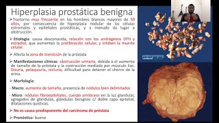 Anatomía Patológica  Hiperplasia prostática benigna y Adenocarcinoma de próstata [upl. by Margarethe653]