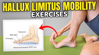 Big Toe Mobility Exercises Hallux Limitus [upl. by Sidnee890]