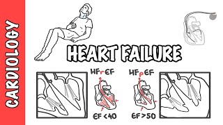 Heart failure with reduced and preserved ejection fraction pathophysiology and treatment [upl. by Trutko449]