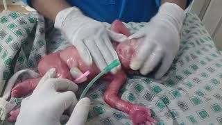 New born baby preterm 32 weeker baby is week and low birth weight but baby is alive removing vernix💞 [upl. by Lecirg]